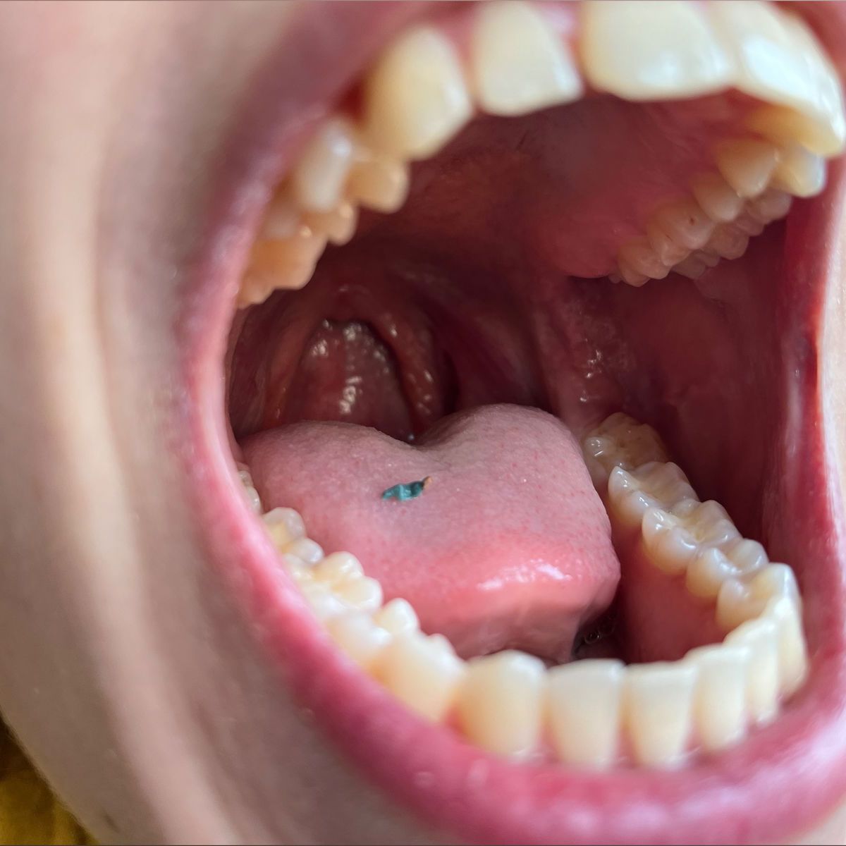 giantesselixs banner